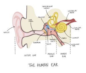 vestibular neuritis